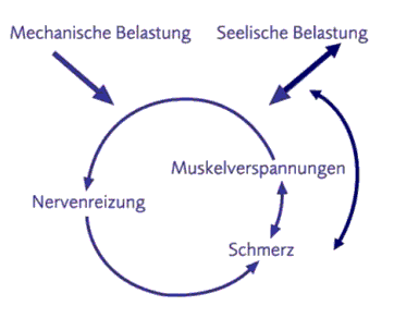 Teufelskreis bei akuten Rückenschmerzen