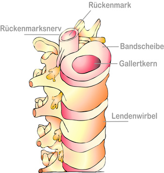 Wirbelsäule